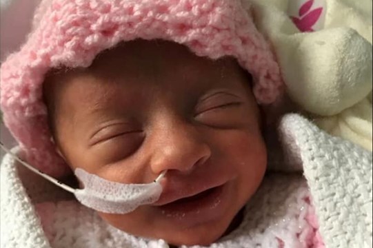 La Sonrisa De Una Bebe Prematura Que Vencio El Covid 19 Y Se Hizo Viral Tendencias Telefe Com