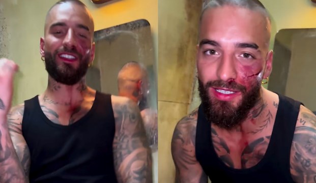 Maluma sorprendió a sus seguidores con un radical cambio de look -  Entretenimientos - mitelefe.com